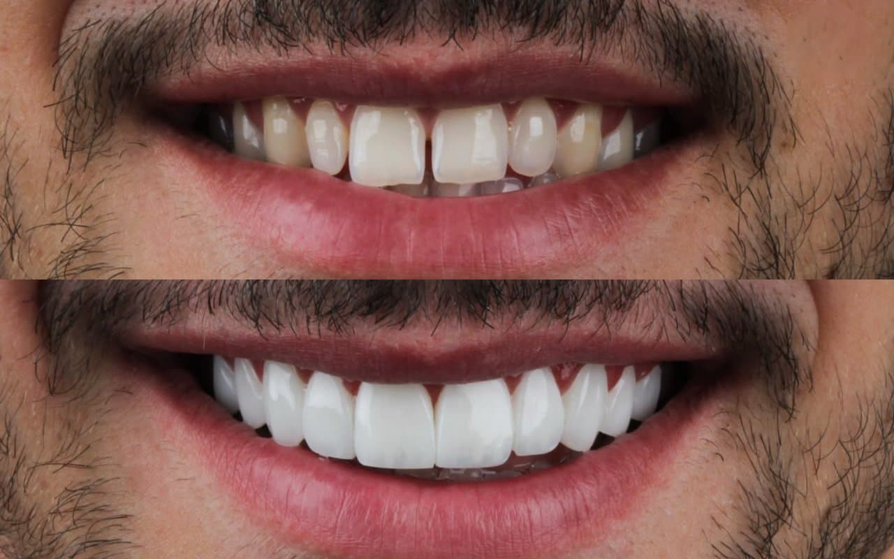 Dentística